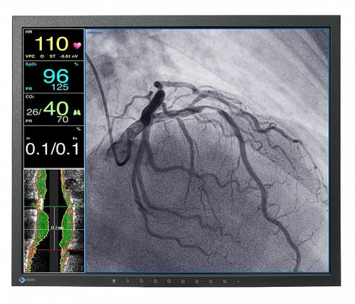 Monitor médico - CuratOR® LX1910 - EIZO GmbH - de diagnóstico / 19" / LCD
