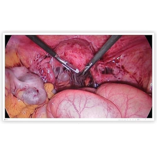 Monitor quirúrgico - CuratOR® EX4342-3D - EIZO GmbH - médico / para sala de operaciones / para endoscopia
