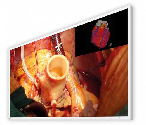 Monitor quirúrgico - CuratOR® EX4342 - EIZO GmbH - médico / para sala de operaciones / 4K