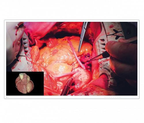 Monitor para endoscopia - EX4942 - EIZO GmbH - para sala de operaciones / quirúrgico / 4K