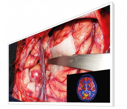 Monitor para endoscopia - EX5542 - EIZO GmbH - para sala de operaciones / quirúrgico / 4K