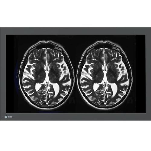Monitor médico - LX3240-MR - EIZO GmbH - Full HD / 4K / 16:9