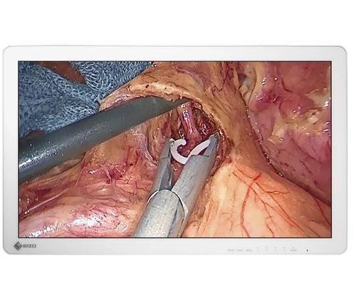 Monitor para endoscopia - EX2721 - EIZO GmbH - para sala de operaciones / quirúrgico / Full HD