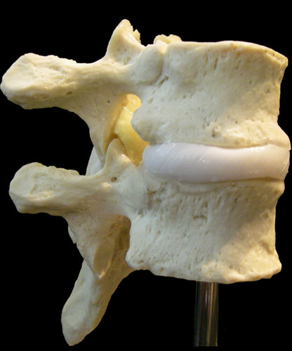 Modelo anatómico de discos intervertebrales - Dynamic Disc Designs Corp. - de vértebras torácicas / ginecológico / de formación