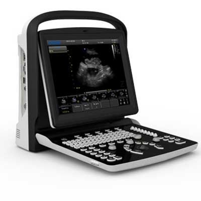 Ecógrafo veterinario portátil - Chison Eco3 - Diagnostic Imaging Systems - multifuncional / para animales pequeños / para animales grandes