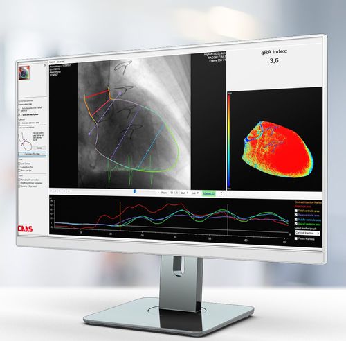 Software de análisis de imágenes - Pie Medical Imaging - de diagnóstico / de medición / de planificación de tratamiento