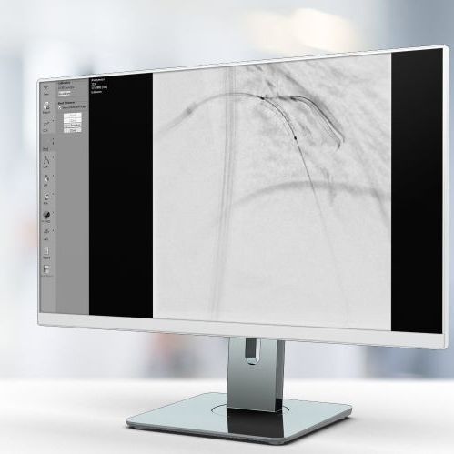 Software de mejora de la imagen - StentEnhancer - Pie Medical Imaging - de visualización / médico / de cardiología