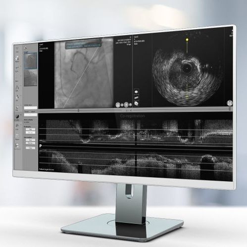 Software de visualización - IV-LINQ - Pie Medical Imaging - de angiografía / para tablet PC