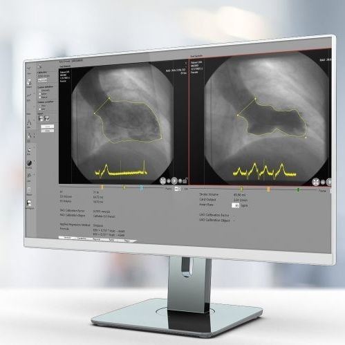 Software de análisis - RVA - Pie Medical Imaging - para informes / de calibración / de detección de contornos