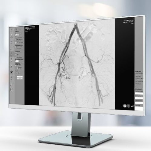 Software de análisis - QVA - Pie Medical Imaging - para informes / de tratamiento / de evaluación