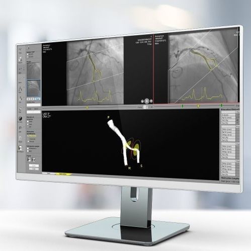 Software de análisis - QCA  - Pie Medical Imaging - para informes / de calibración / de detección de contornos
