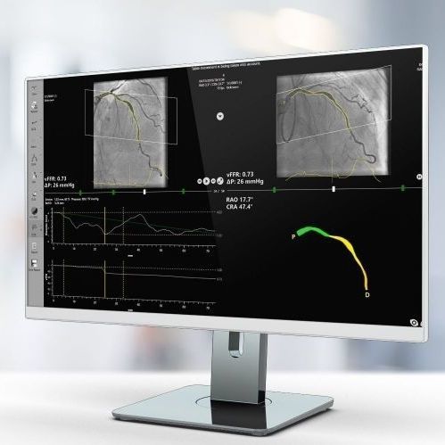 Software de análisis - vFFR - Pie Medical Imaging - de visualización 3D / médico / de hospital