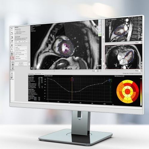 Software de análisis - Pie Medical Imaging - para informes / médico / para IRM