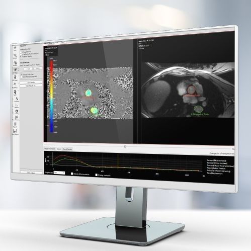 Software de análisis - Pie Medical Imaging - para informes / de visualización / de filmación de inspección