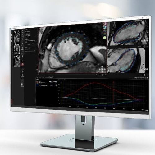 Software de análisis - MR Strain - Pie Medical Imaging - con sistema de seguimiento / médico / clínico