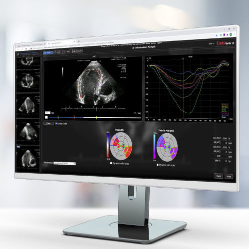 Software de análisis - Qardia - Pie Medical Imaging - para informes / de medición / médico