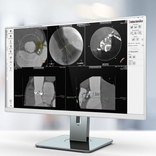Software de análisis - Pie Medical Imaging - para informes / de visualización / de medición