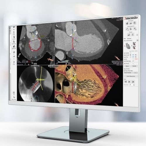 Software de análisis - Pie Medical Imaging - para informes / de visualización / de planificación