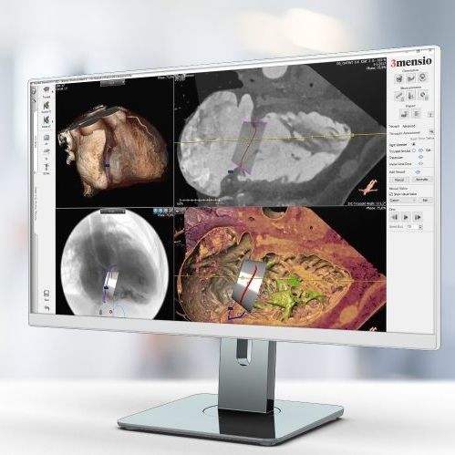 Software de análisis de imágenes - Pie Medical Imaging - para informes / de importación / médico