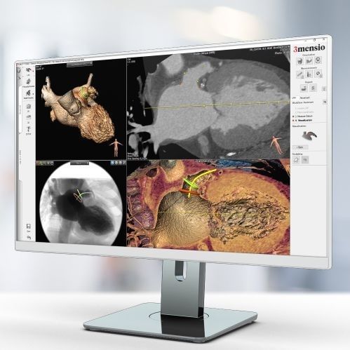 Módulo de software de visualización 3D - Pie Medical Imaging - de diagnóstico / de planificación / médico