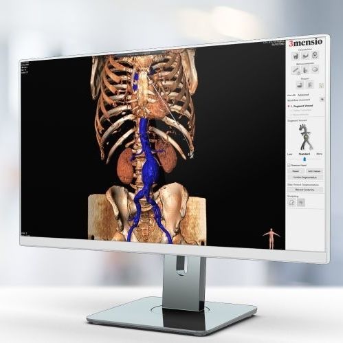 Software de análisis de imágenes - Pie Medical Imaging - de planificación / de tratamiento / médico