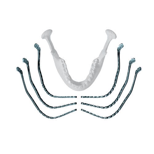 Placa de compresión para mandíbula - MatrixMANDIBLE™  - Depuy Synthes - porción distal / bloqueada / metálica