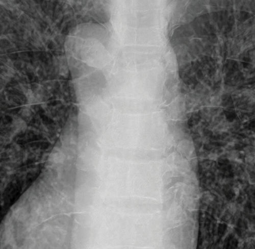 Plataforma de IA para imágenes médicas - DEPAI™ - DRTECH - de mejora de la imagen / de diagnóstico / procesos basados en la web