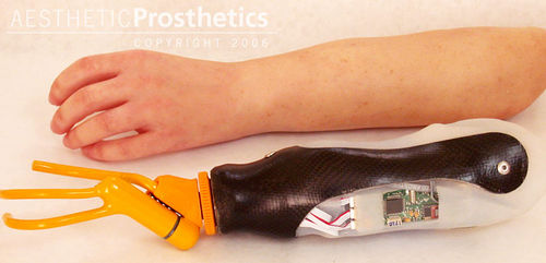 Prótesis de mano mioeléctrica - Aesthetic Prosthetics - pinza gancho / para adulto