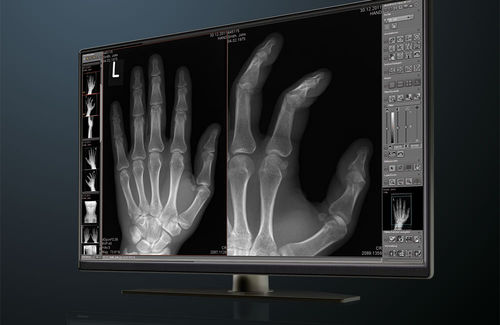 Software de gestión - dicomPACS® Basic - OR Technology - Oehm und Rehbein - para imágenes médicas / para IRM