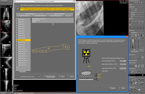 Módulo de software de planificación - dicomPACS® vet Prosthesis  - OR Technology - Oehm und Rehbein - para cirugía ortopédica / veterinario