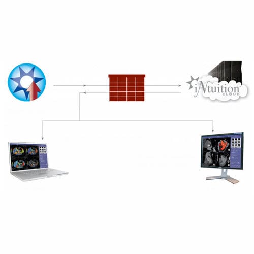 Solución de informática en la nube para el sector médico - iNtuition CLOUD - TeraRecon