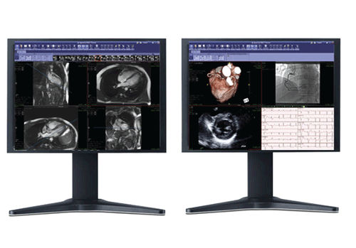Software de oncología - iNtuition REVIEW - TeraRecon - cardiovascular / para imágenes médicas / de visualización 3D
