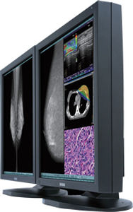 Monitor médico - CCL550i2 - TOTOKU - mamográfico / 21.3" / LCD