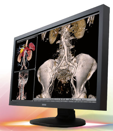 Monitor médico - CCL650i2 - TOTOKU - de diagnóstico / 30" / LCD