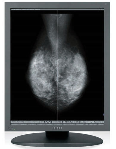 Monitor médico - MS55i2 - TOTOKU - mamográfico / de alta definición / LCD