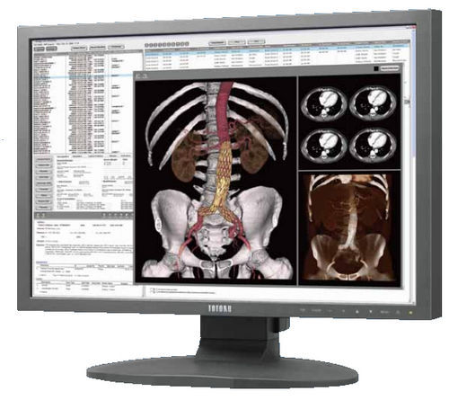 Monitor para imágenes médicas - CCL242 - TOTOKU - 24" / LCD / con retroiluminación LED