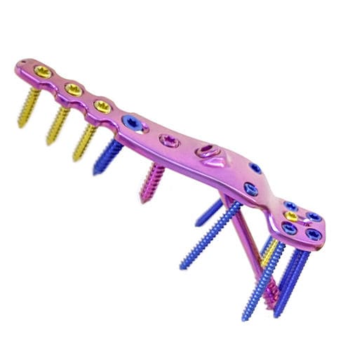 Placa de artrodesis para tobillo - HJ-VA-LOC 07 - Health-Joy Medical - lateral / bloqueada / de titanio