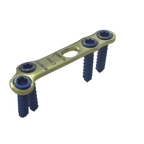 Placa de artrodesis para articulación metatarsofalángica - HJ-VA-LOC15 - Health-Joy Medical - para articulación tarsometatarsiana / para metatarso / bloqueada