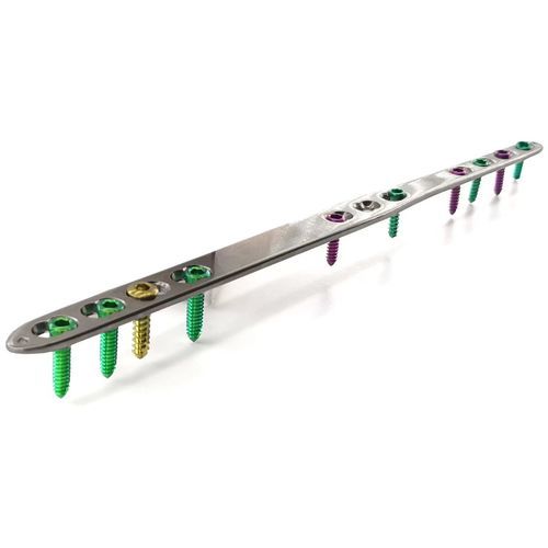 Placa de artrodesis para muñeca - HJ-Small Dorsal Spanning - Health-Joy Medical - para carpo / para falange de la mano / para articulación metacarpofalángica