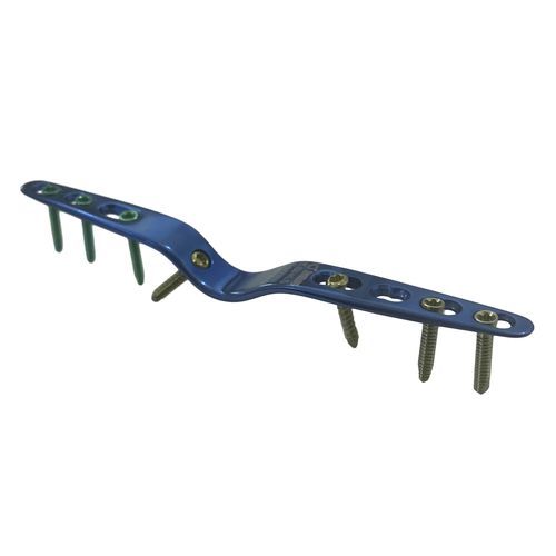 Placa de artrodesis para muñeca - HJ-Small Hand Fusion - Health-Joy Medical - para carpo / para articulación metacarpofalángica / porción distal