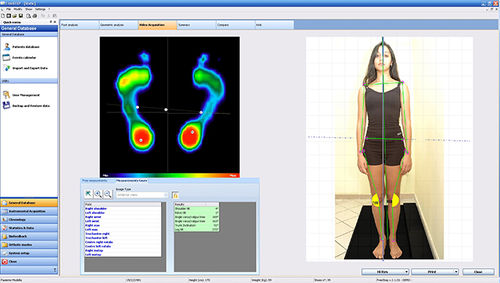 Software de análisis - Sensor Medica - para podología