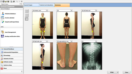 Software de análisis - Sensor Medica - de medición / de posturología