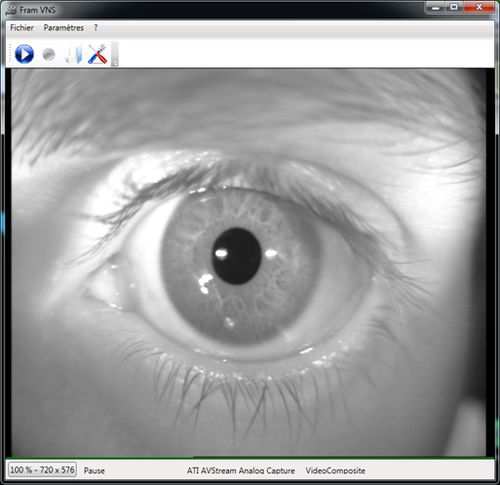 Software de grabación de vídeo - FRAMVIDEO - Framiral - médico / de grabación de vídeo