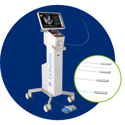 Sistema de imágenes endoscópicas CLE - CELLVIZIO®  - Mauna Kea Technologies - broncoscopia