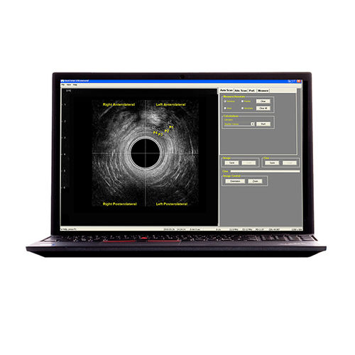 Ecógrafo portátil - (RTCU-S-N) Morpheus® 360° Endocavity US  - The Prometheus Group - para ecografía ginecológica y obstétrica / para ecografía colorrectal / blanco y negro