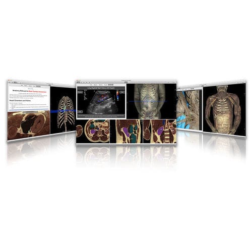 Software de formación - VH Dissector - Touch of Life Technologies (ToLTech) - de anatomía