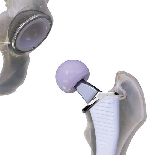 Prótesis de cadera de primera intención - Cordera™  - ConforMIS - no cementada