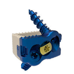 Caja intersomática cervical - Dakota ACDF™ - Precision Spine - vía anterior / de titanio / de PEEK
