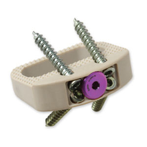 Caja intersomática lumbar - Vault® - Precision Spine - vía anterior / de PEEK