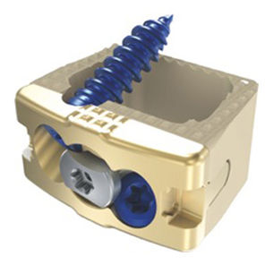 Caja intersomática cervical - Vault%u2122%uFEFFC - Precision Spine - vía anterior / de titanio / de PEEK